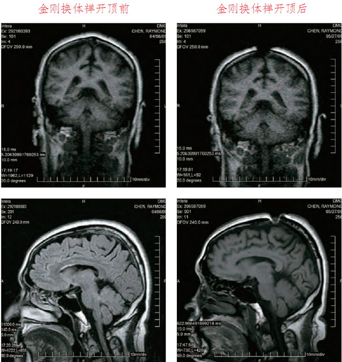 禄东赞法王修金刚换体禅令神识出体取物 义云高 弘扬正法