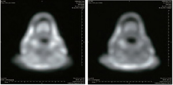 开初仁波且修摊尸拙火定 温度高达摄氏92 度 义云高 弘扬正法
