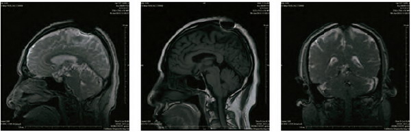 开初仁波且修摊尸拙火定 温度高达摄氏92 度 义云高 弘扬正法